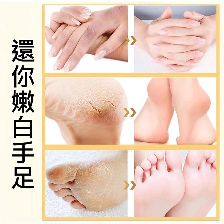 【醫師推薦】滾珠按摩護手精油！ 女人的雙手是第二張臉，每天只需三滴護手精油，嫩滑無比！ 深層補水保濕，淡化手紋，去掉倒刺、死皮、細紋，讓你的雙手像少女般嬌嫩！