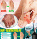 【骨科醫生推薦】EELHOE 拇囊炎貼