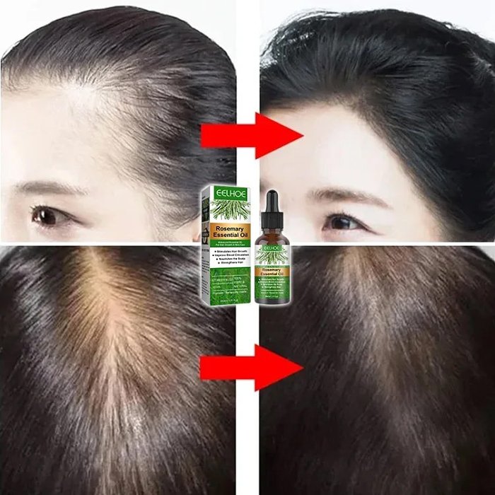 Rosemary Hair Growth Essential Oil