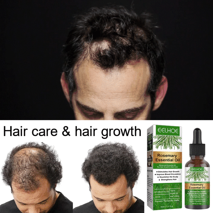 Rosemary Hair Growth Essential Oil