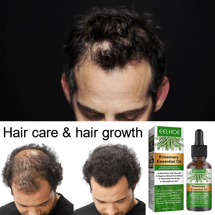 Rosemary Hair Growth Essential Oil