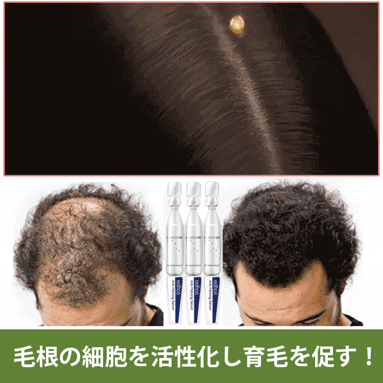 【日本名醫推薦】脫發嚴重！情緒總是會感到低落，羨慕頭發多的人？你也可以的！EELHOE密發頭發修復液，一周就能讓您見到毛孔長出了短短的頭髮啦！（1.5ml*10pcs/盒）