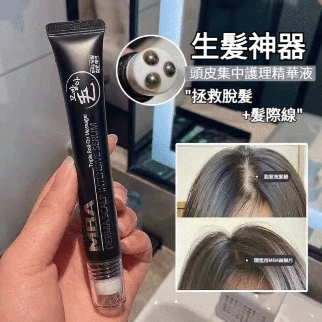 終於不禿了,碎髮爆炸!濃密度提升2倍!韓國超夯mba生髮液,拯救脫髮_髮際線,天然溫和草本,護理頭皮,喚醒毛囊,強韌髮根,不刺激頭皮!無副作用!