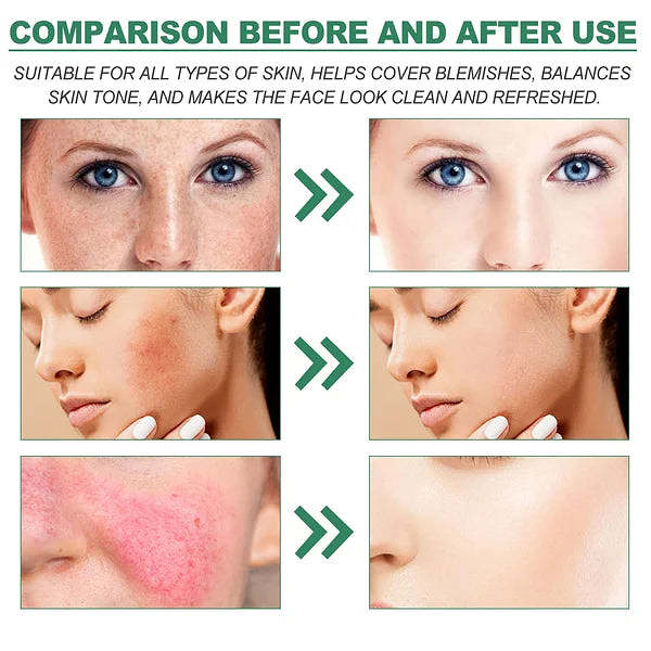 🔥HOT SALE-50% OFF 🔥COLOR CORRECTING TREATMENT CREAM
