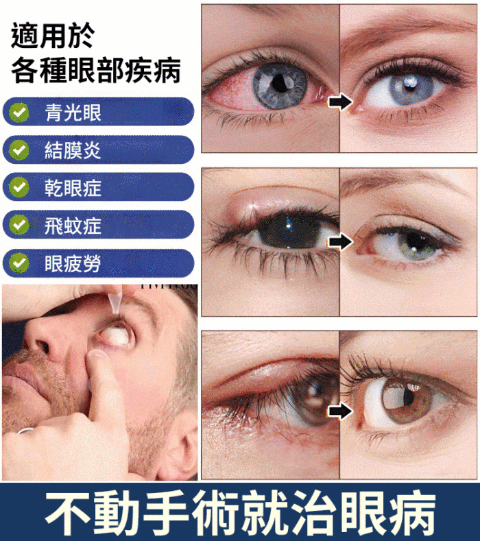 Ximonth 瑞士老花眼眼藥水