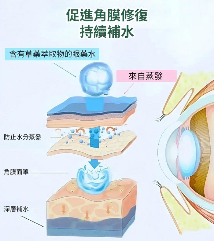 Ximonth 瑞士老花眼眼藥水