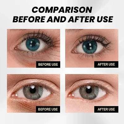 🔥Hot Sale🎁50% OFF!!🔥CËLYN® FIRM Eye Tightener