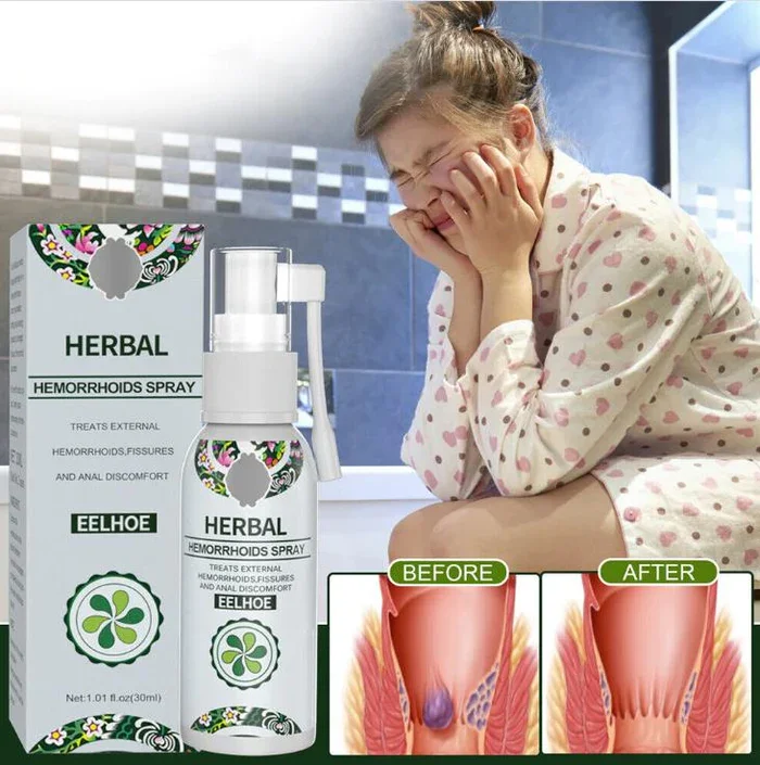 NATURAL HERBAL HEMORRHOIDS SPRAY HEMORRHOID RELIEF CREAM, FOR SOOTHING EXTERNAL HEMORRHOIDS CALMS, ITCHING BURNING