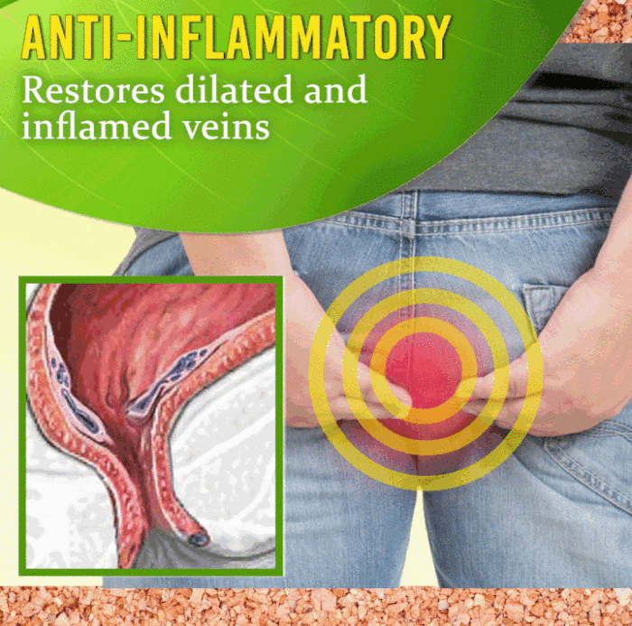 Hemorrhoids elimination ointment FDA certification