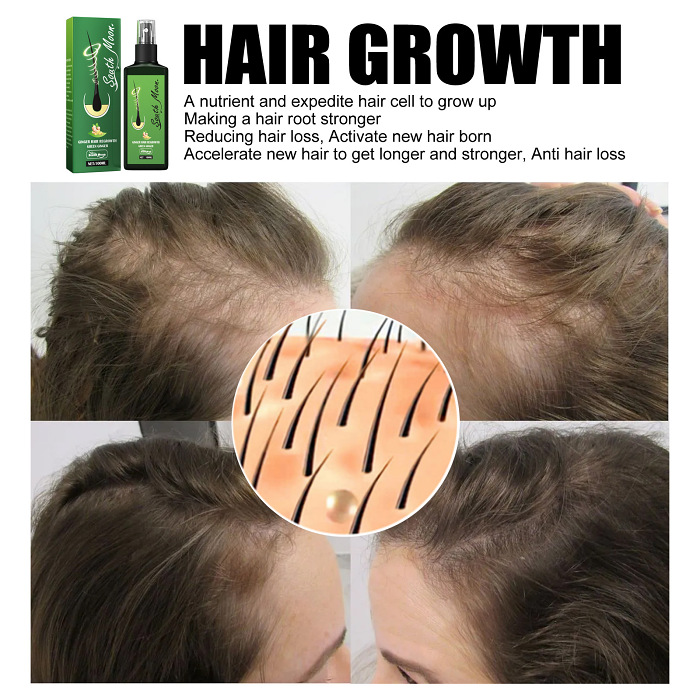 South Moon Hair Nutrition Spray Strengthens Hair Moisturizing Hydrating Prevents Hair Loss Scalp Care Solution