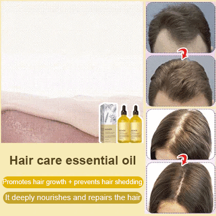 天然迷迭香生髮精油 Natural Rosemary Hair Growth Essential Oil