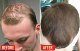 天然迷迭香生髮精油 Natural Rosemary Hair Growth Essential Oil