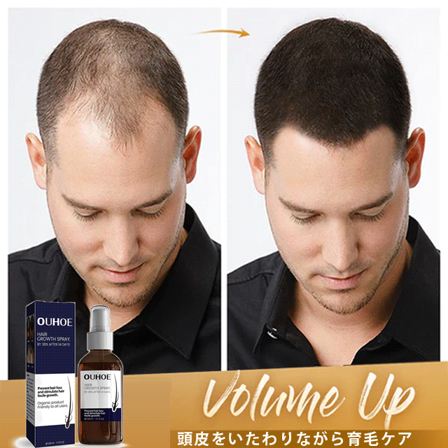 A hair growth tool specially developed for hair.🔥 A must use it for hair, beard, eyebrow and eyelash growth!