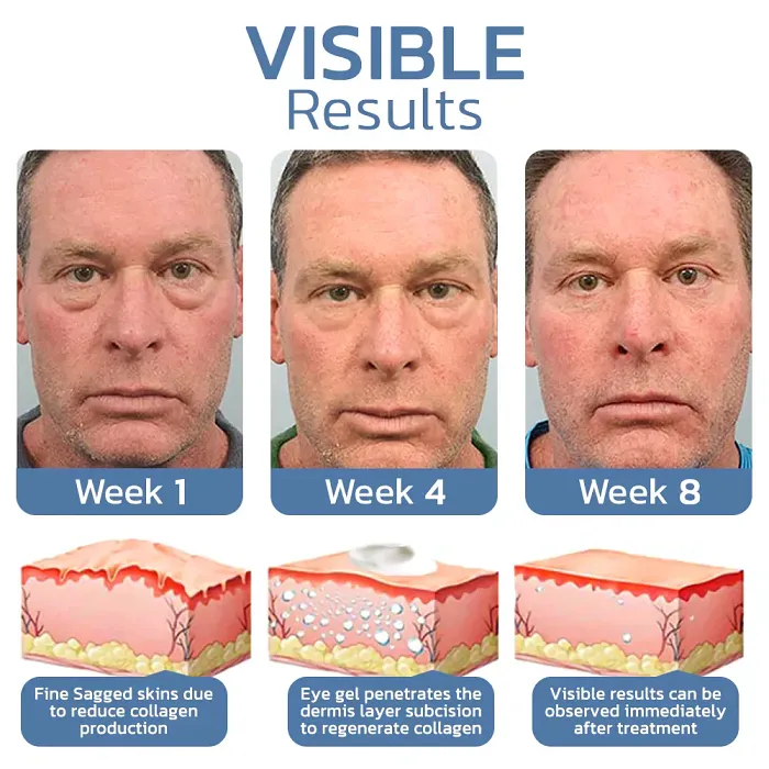 OPENEYES AWAKEN PEPTIDE LIFTING GEL FOR EYES