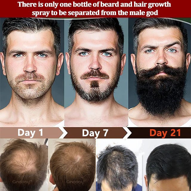 Hair Growth Spray