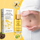 🐝🐝IntestiDetox Bee Venom Belly Button Drops Lymphatic Detoxification - Last Day Promotion✨✨✨