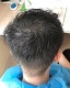 【台美共研】毛囊幹細胞生發噴霧 ，深層滋養毛囊，促進毛囊修復，增加毛囊數量，促進毛髮生長，防脫強髮根。 循序漸進，從無到有，從稀少到稠密，重新喚回屬於你的髮