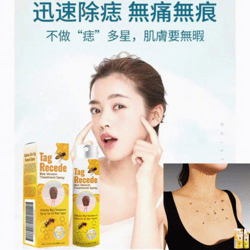 TagRecede蜂毒克疣護理噴露 清潔淡化身體肉痣，平滑肌膚修譙噴霧