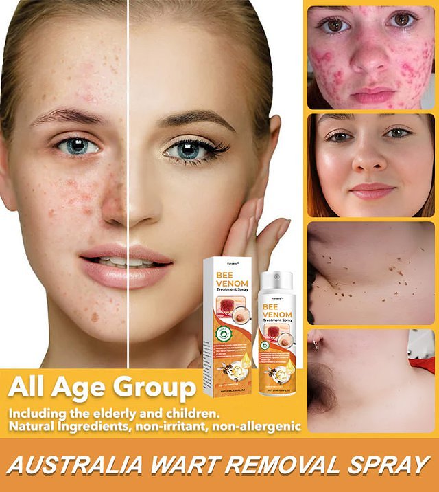 Australia Wart Care Spray
