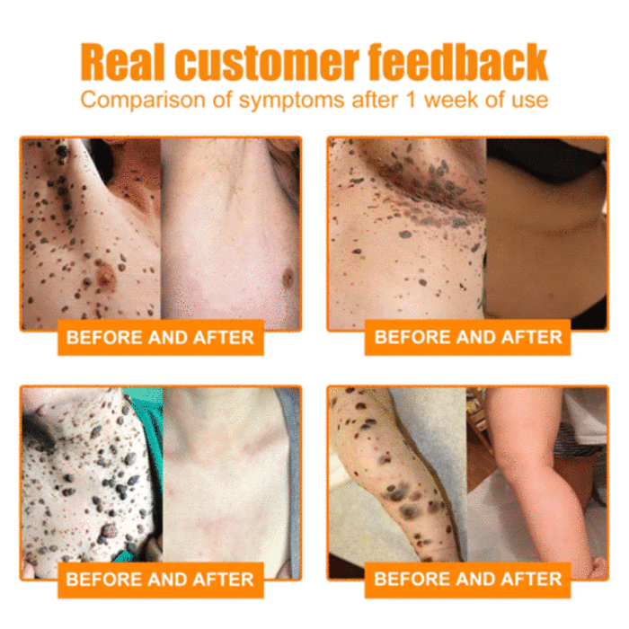 Bee Venom Skin Care Cream