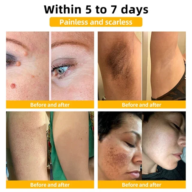 Bee Venom Skin Care Cream