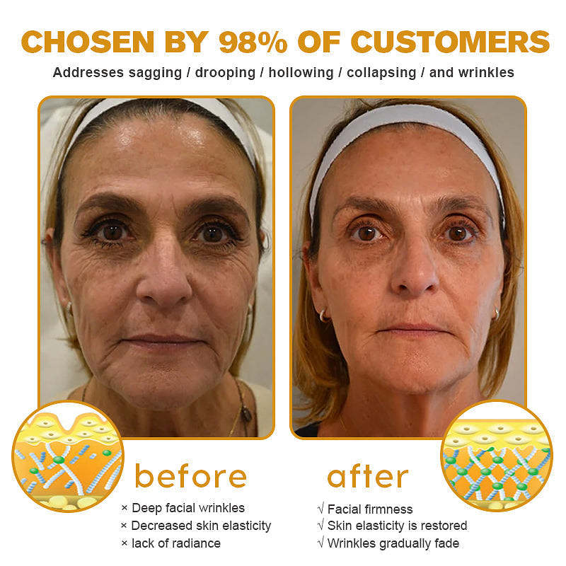 MHRA Approved✨Furzero™ Botox Bee Venom Wrinkle Removal Cream-Last Day Promotion 70% OFF