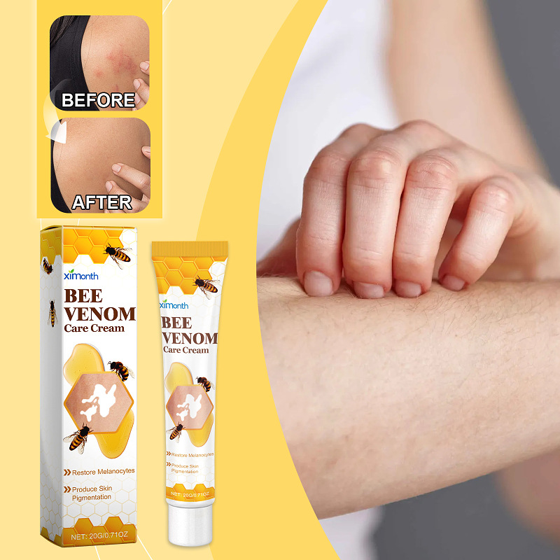 Ximonth™ BeeVenom Vitiligo Treatment Cream