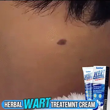 Wart Remover Gel