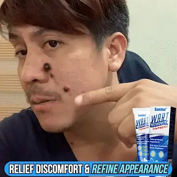 Wart Remover Gel