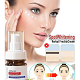 🔥【Limited time offer, buy 1 get 1 free,】🔥Vitamin C Whitening Freckles Face Cream Remove Melasma Dark Spots Lighten Melanin
