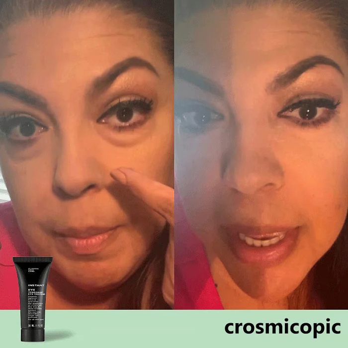 EyeLift Instant Firming Cream | BUY 1 GET 1 FREE