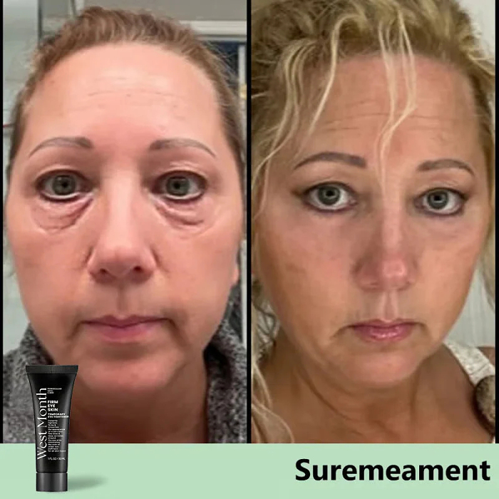 EyeLift Instant Firming Cream | BUY 1 GET 1 FREE