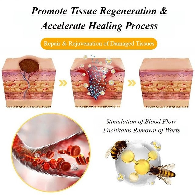 TagRecede Bee Venom Wart Treatment Spray