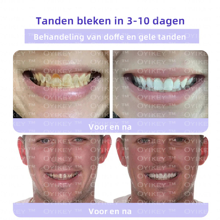 💕OyikeyTM  TOOTH RESTORATIONMINERAL POWDER(ADA recommended)