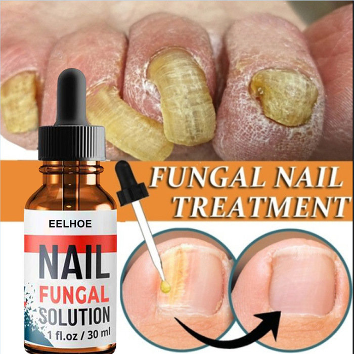 Nail Repair Liquid Hand and Foot Grey Nail Care-Nail care solution