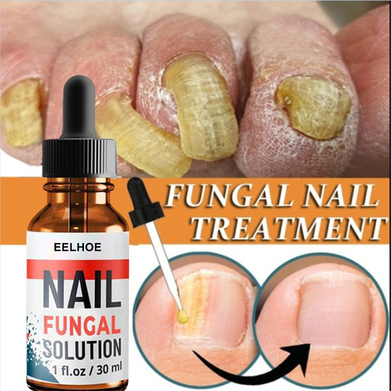 Nail Repair Liquid Hand and Foot Grey Nail Care-Nail care solution