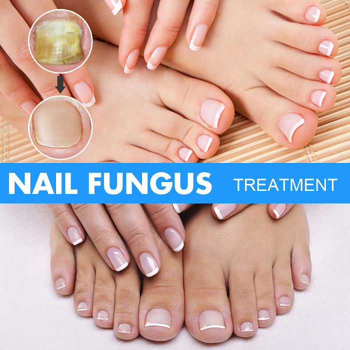 Nail Repair Liquid Hand and Foot Grey Nail Care-Nail care solution