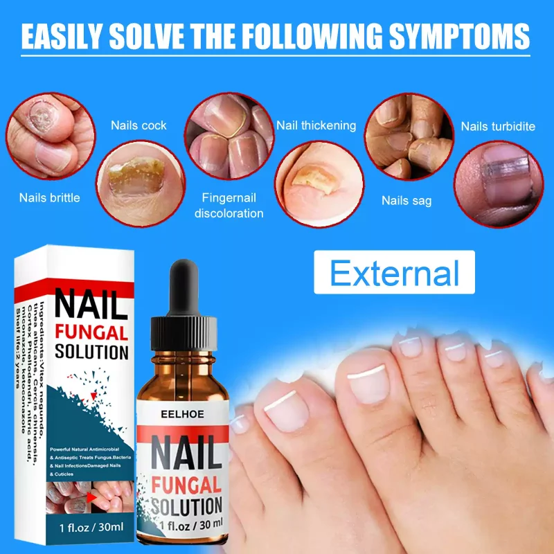 Nail Repair Liquid Hand and Foot Grey Nail Care-Nail care solution