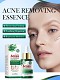 Tea Tree Essence