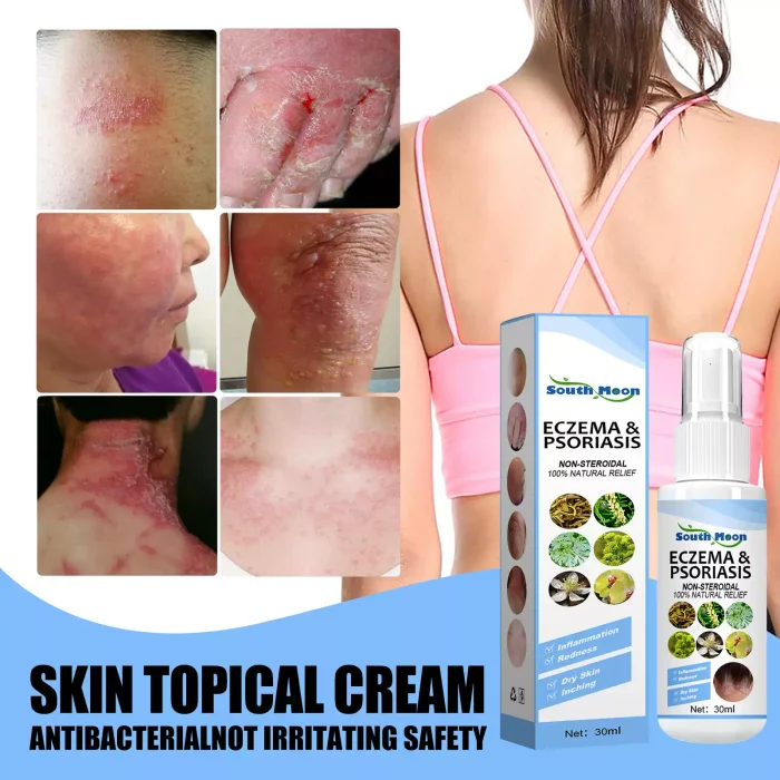 Skin repair spray moss cowhide moss