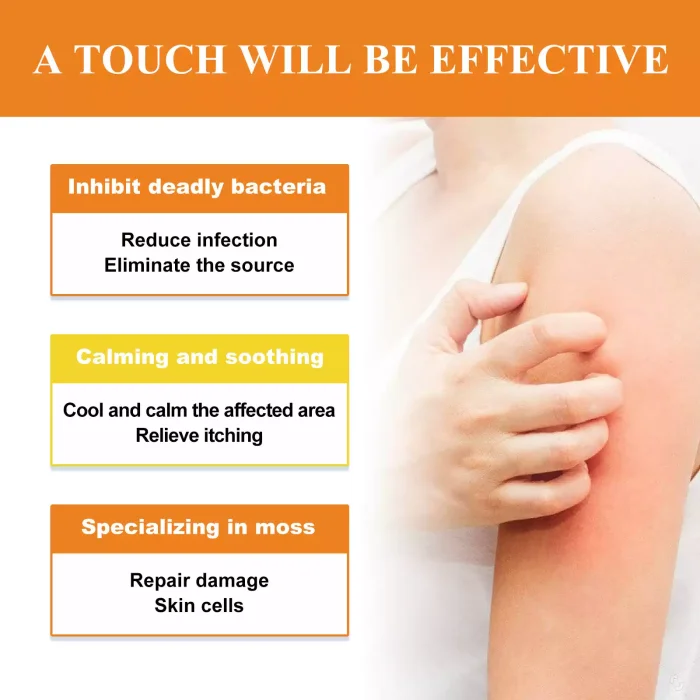 Skin repair cream relieves skin itching