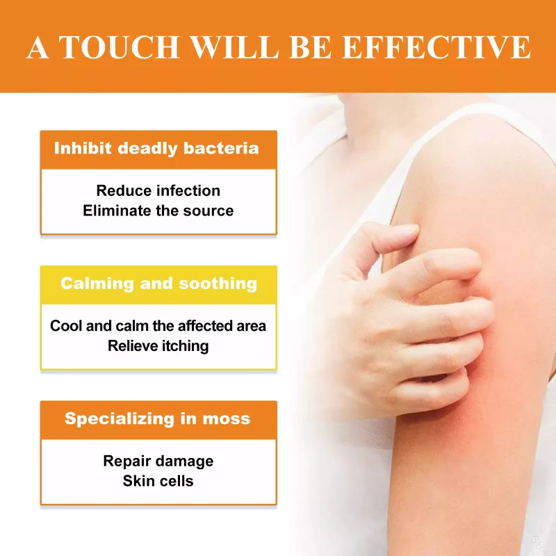 Skin repair cream relieves skin itching
