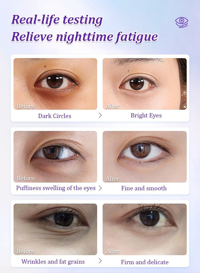 Hyaluronic Acid and Pro-Xylane Anti-Wrinkle Eye Cream