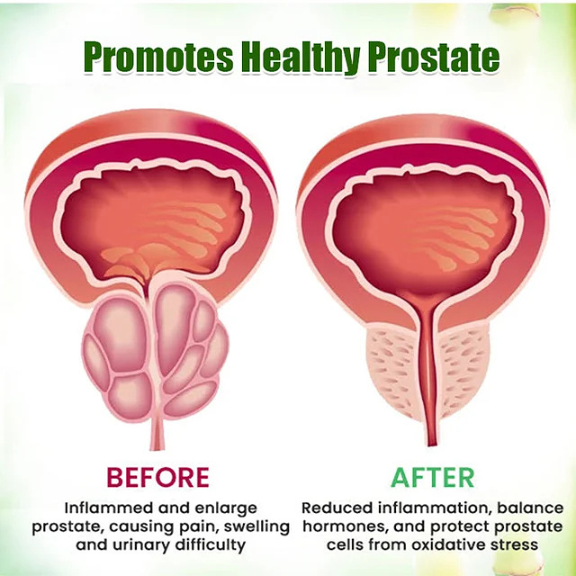 Prostate Care Foot Patch