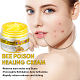 Bee Venom Care Cream-Used to remove warts acne scars and Wrinkle removal