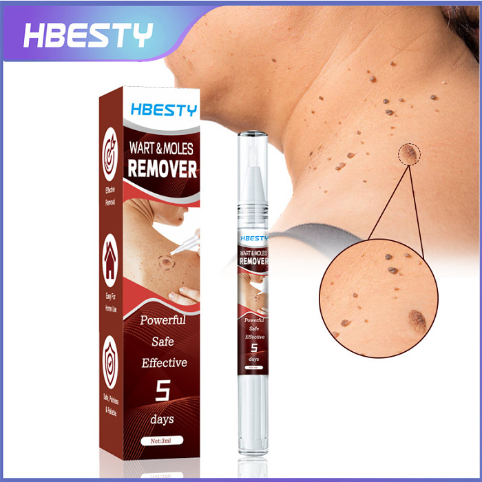 ESSENCE FOR TREATING SKIN TAGSAND WARTS HBESTY