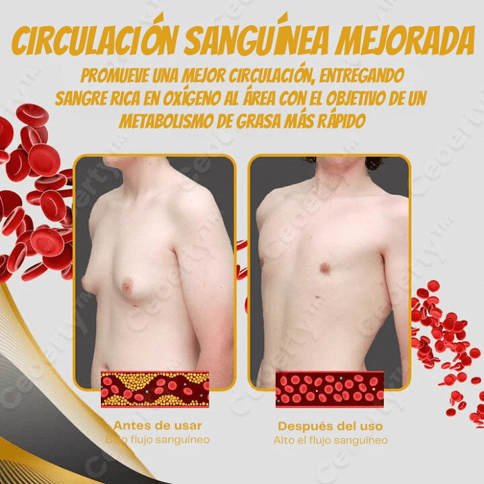 Gynecomastia Bee Venom oil