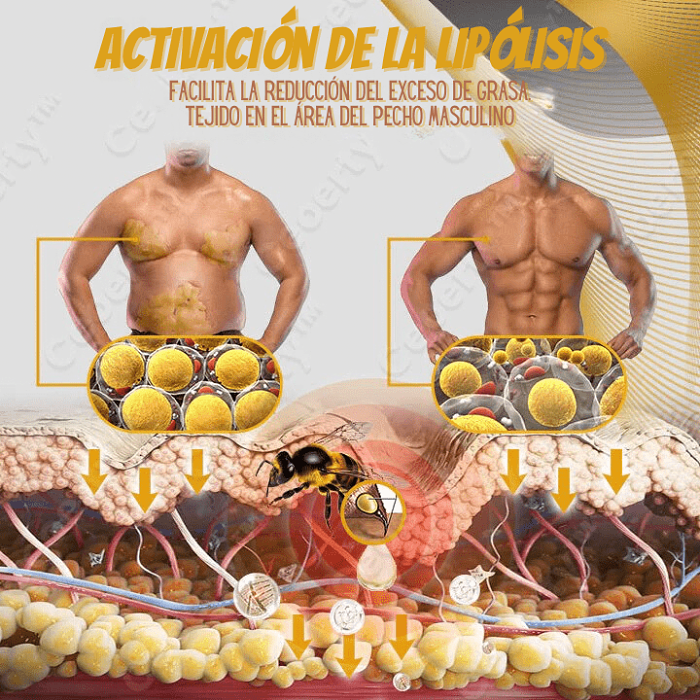Gynecomastia Bee Venom oil