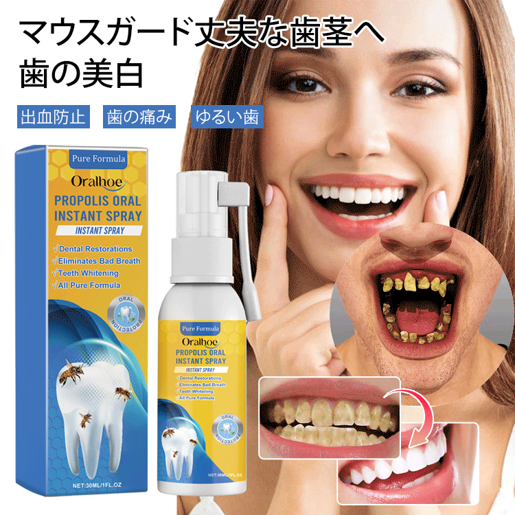 🦷日本齒科醫師協會及👨‍⚕️東大醫學院共同研製【Oralhoe蜂胶口腔护理喷雾】已拯救百萬各類牙齒疼痛、殘缺、不齊、口臭等問題人士✅減輕炎症、美白牙齒、除口臭、恢復牙齦健康💟輕鬆便捷，出門隨身帶🩸促進牙齦再生長，延長牙齒壽命👍輕鬆解決牙裂/牙洞/牙縫/牙垢