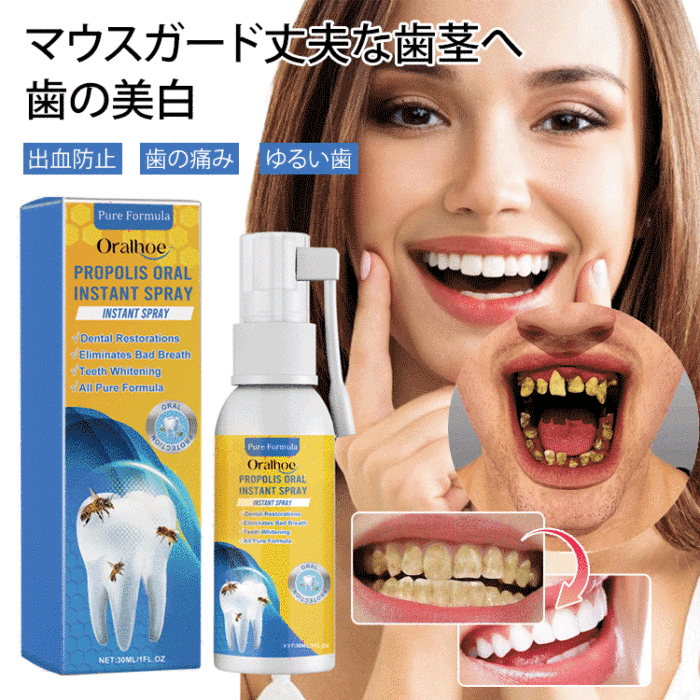 🦷日本齒科醫師協會及👨‍⚕️東大醫學院共同研製【Oralhoe蜂胶口腔护理喷雾】已拯救百萬各類牙齒疼痛、殘缺、不齊、口臭等問題人士✅減輕炎症、美白牙齒、除口臭、恢復牙齦健康💟輕鬆便捷，出門隨身帶🩸促進牙齦再生長，延長牙齒壽命👍輕鬆解決牙裂/牙洞/牙縫/牙垢